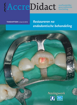 Restaureren na endodontische behandeling 1