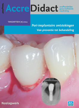 Peri-implantaire ontstekingen: van preventie tot behandeling