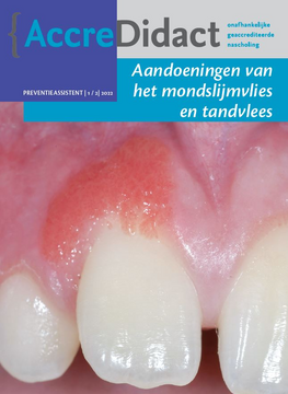 Aandoeningen van mondslijmvlies en tandvlees - deel 1