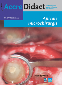 Apicale microchirurgie